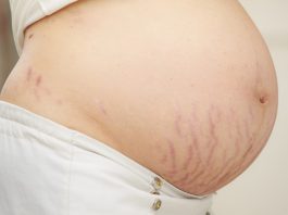 Top 5 Common Skin Problems of Pregnant Women
