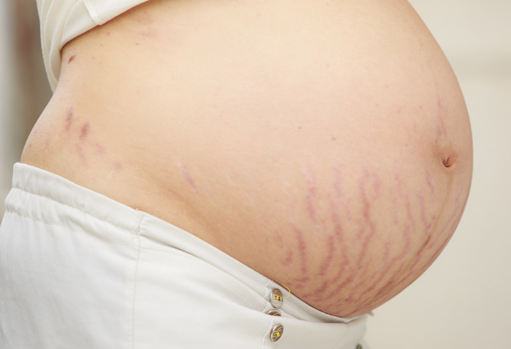 Top 5 Common Skin Problems of Pregnant Women